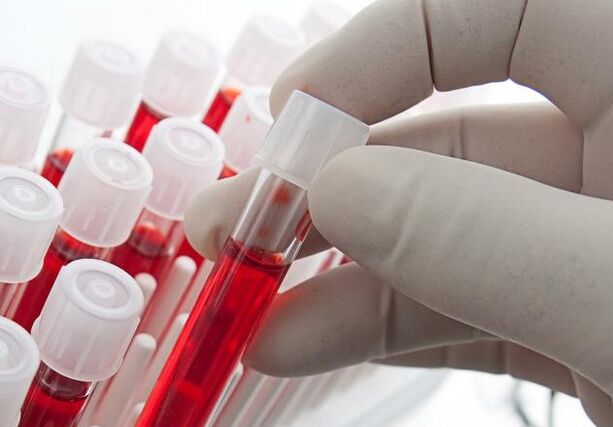 alkol içtikten sonra kan testi